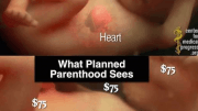 Il listino prezzi delle varie parti del corpo dei bambini abortiti.