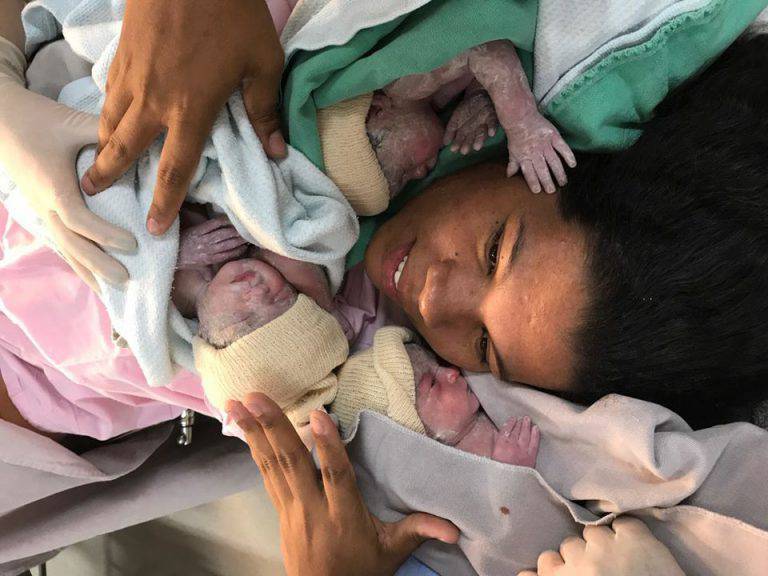 Mamma “eroina” in Brasile: va da sola in ospedale e dà alla luce 3 gemelle con parto naturale